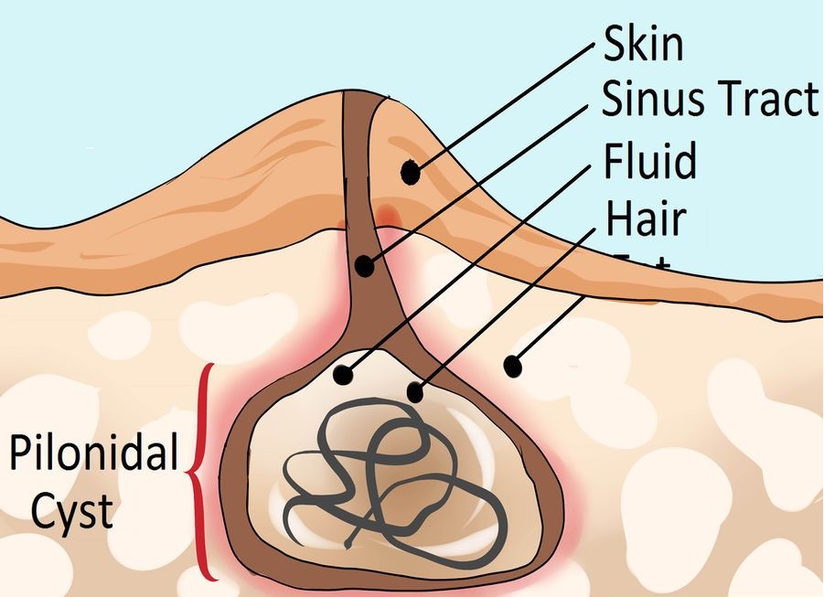 Laparoscopic Surgeon in Nashik , General Surgeon in Nashik