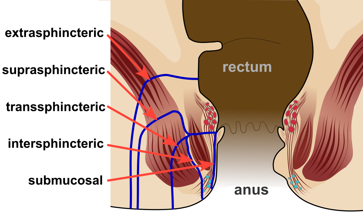 Hernia Surgeon in Nashik , Piles Doctor in Nashik