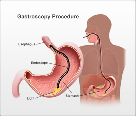 GallBladder Surgeon in Nashik , Appendix Surgeon in Nashik