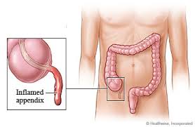 Appendix Surgeon in Nashik