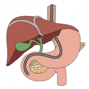 Gall Bladder Surgeon in Nashik